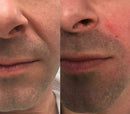 Máscara de Contorno Facial - Suaviza Rugas, Papada e Modela o Rosto