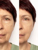 Creme antí-flacidez lifting instantâneo ROLON FIRMx®