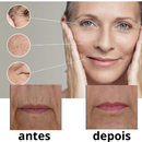 Face lift rejuvenescedor instantâneo