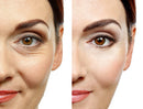 Face lift rejuvenescedor instantâneo