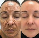 Spray Rejuvenescedor 577