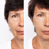Creme Lifting Firmador Remover Rugas em 60 segundos