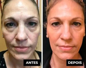 Placenta Glow Rejuvenescimento Celular