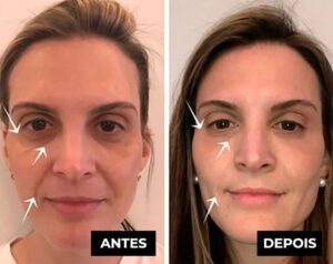 Placenta Glow Rejuvenescimento Celular
