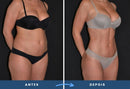 Adesivos de Moringa Emagrecedor 7 pacotes