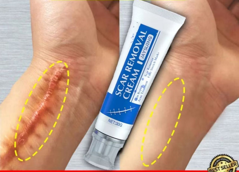 REMOVEDOR DE VERRUGAS E CICATRIZES CREME DR.VERRUGA