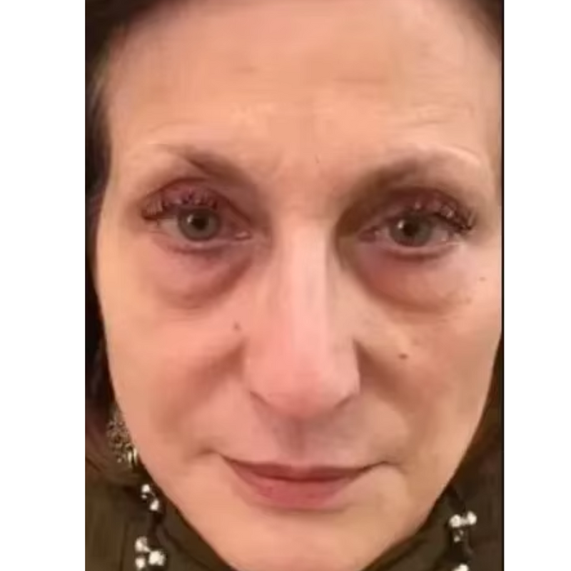 Retinol Coreano Rejuvenescedor