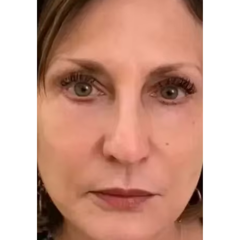 Retinol Coreano Rejuvenescedor