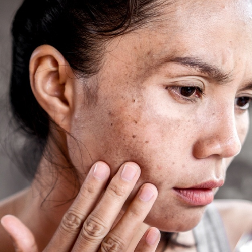 Retinol Coreano Rejuvenescedor