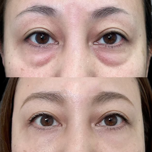 Retinol Coreano Rejuvenescedor