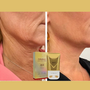 Creme Roller botox3 em 1 Papada Pescoço e Colo